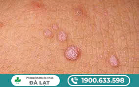 Hình ảnh minh họa